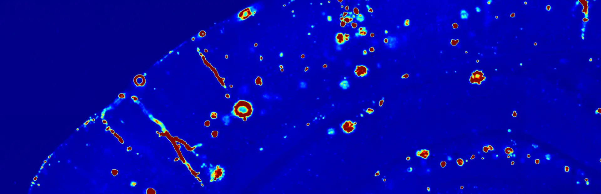 Getting down to the roots of Alzheimer’s disease Getting down to the roots of Alzheimer’s disease