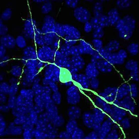 Mutant Protein Spreads Through a Neural Circuit in Huntington’s Disease - Neuron mutant-protein-spreads-through-a-neural-circuit-in-huntingtons-disease-neuron