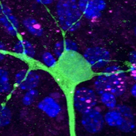 Mutant Protein Spreads Through a Neural Circuit in Huntington’s Disease - 3D Model mutant-protein-spreads-through-a-neural-circuit-in-huntingtons-disease-3d-model